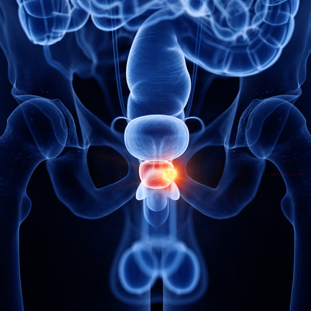 Ultraschall: Prostata und Harnblase